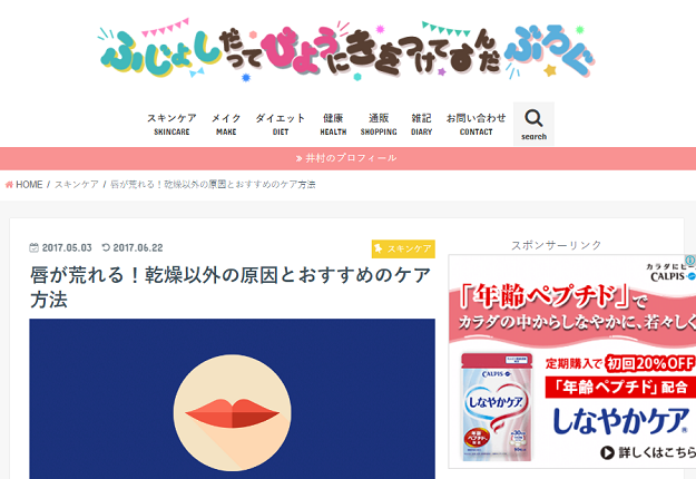いむら